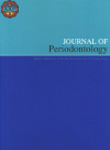 Association between the number of teeth and hypertension in a study based on 13,561 participants