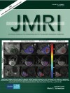 Investigation of the pruritus-induced functional activity in the rat brain using manganese-enhanced MRI.